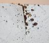 bedbug1.jpg